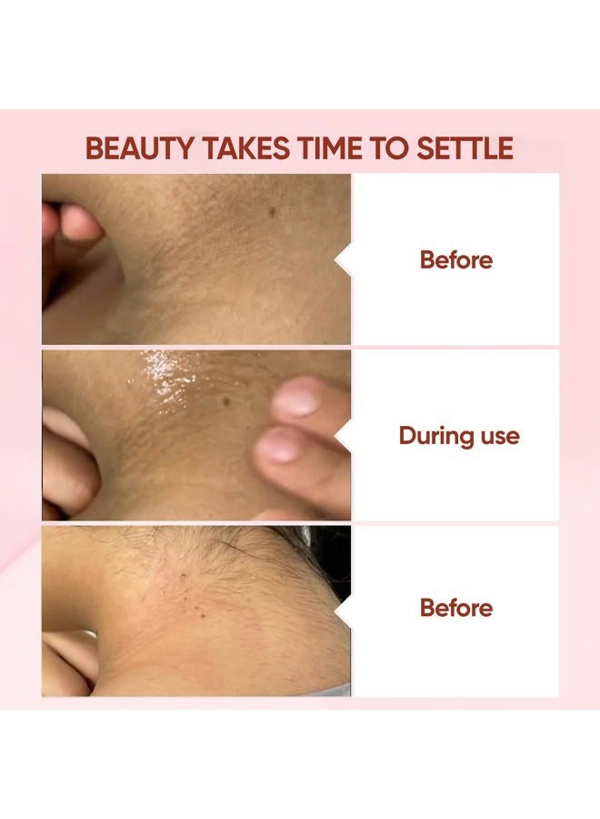 QUARXERY Purifying Exfoliating Gel for Face, 2Pcs Gentle Moisturizing Peeling Gel, Facial Exfoliator Cleanser Removes Dead Skin, Dust and Other impurities for Prevent Acne, with Niacinamide, Vitamin E - Image 4
