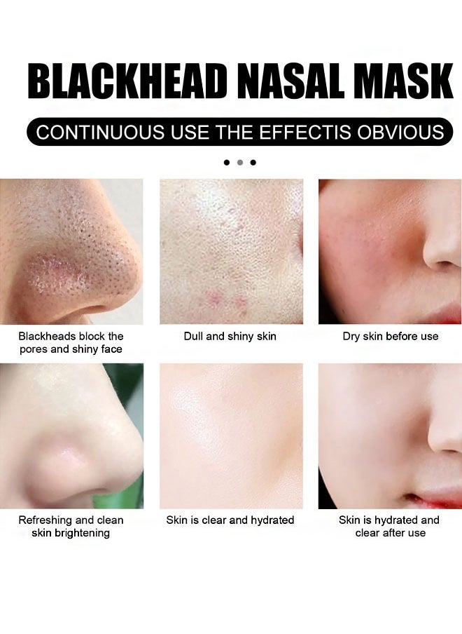 Nose Plant Spore Strips, Deep Cleaning and Shrink Pores, Absore Grease,  Remove Blackheads Nose Patch 30g