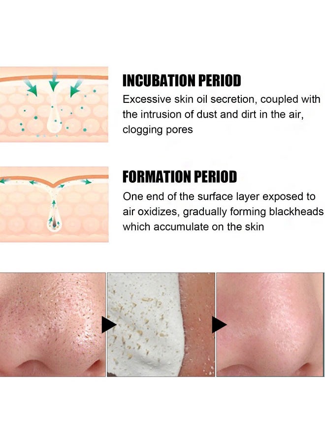 Nose Plant Spore Strips, Deep Cleaning and Shrink Pores, Absore Grease,  Remove Blackheads Nose Patch 30g