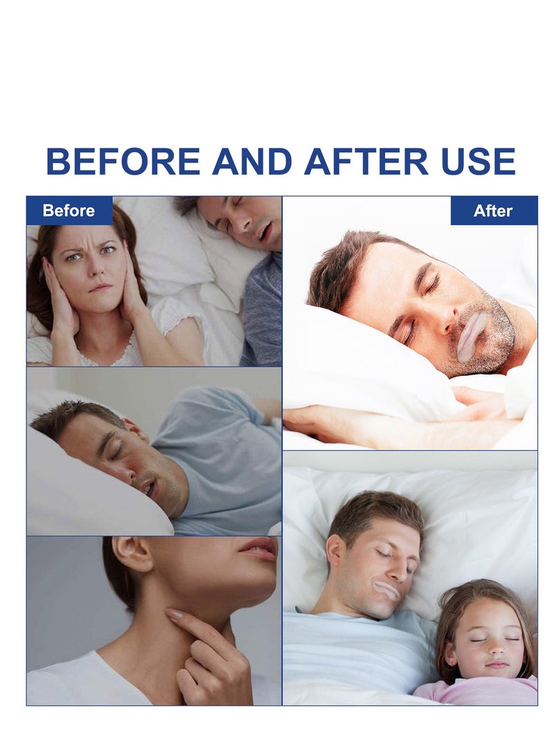 LUNOON - Anti Open Mouth and Closed Mouth Patch for Sleeping Anti Snoring Mouth Tape Sleep Stop Snoring Breathing Patch Suitable for Improving Sleep and Relieving Snoring 90Pcs - Image 1