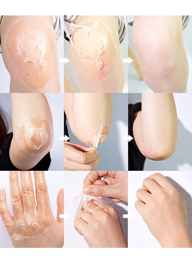 Vitamin C Peeling Lotion 100G, Effectively Soften The Keratin, Improve Rough Epidermis Delay Skin Aging And Make The Skin Soft And Elastic, Whiten And Smooth