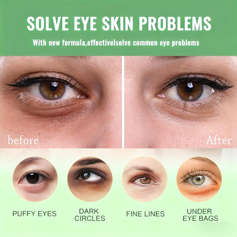 firstfly 60 Pcs Avocado Eye Mask, Under Eye Patches for Dark Circles and Puffiness, Moisturizing Nourishing Eye Treatment Mask, Improving Eye Skin Dryness, Fine Lines and Wrinkles - Image 3