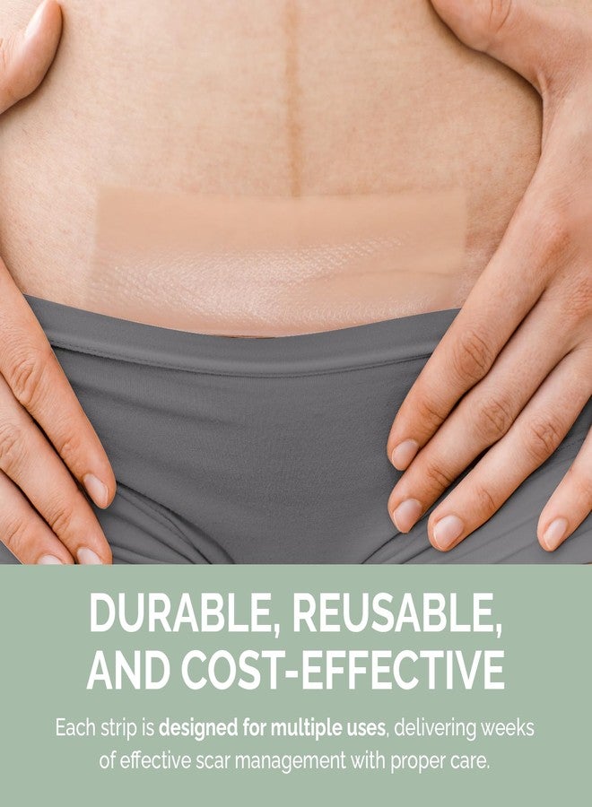 RecoverEase Silicone Scar Strips – Reusable Medical Grade Silicone & Individually Wrapped Scar Sheets for Mastectomy & C-Section, Scar Treatment Tape for Tummy Tuck, Keloid, Surgical, Burns - 6 Pack - Image 4