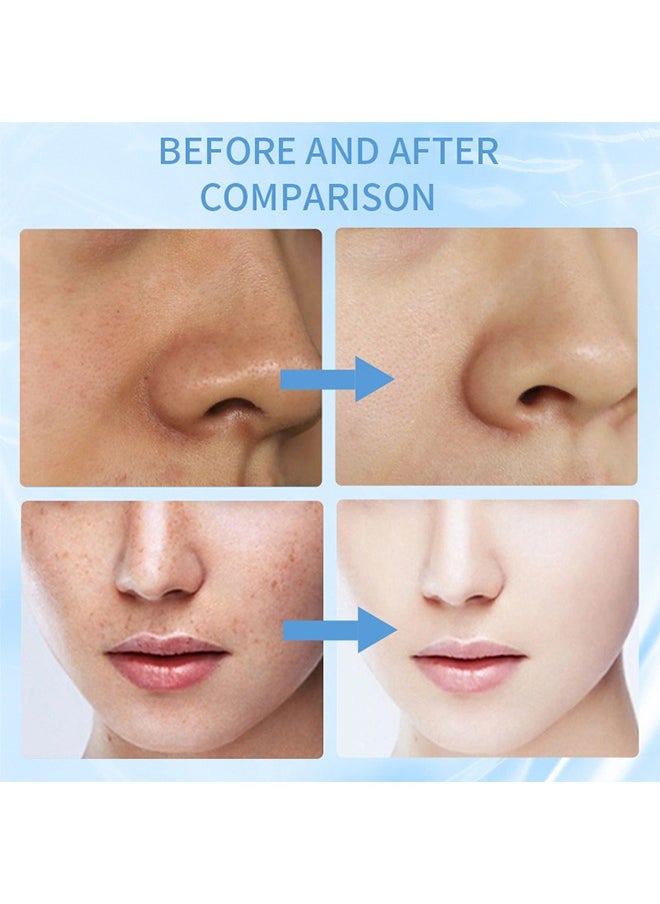 QANZIRE - Vitamin B3 Niacinamide Serum, Niacinamide Face Serum for Women & Men, Skin Brightening Serum Face Care, Anti Aging Serum for Face, Dark Spot Remover Serum, Hydrating Serum, Even Skin Tone 30ml - Image 1