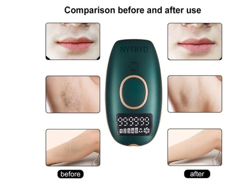 NYTRYD IPL Laser Hair Removal Machine For Women And Men Permanent Painless Laser For Whole Body Upgraded To 999,999 Flashes At-Home Hair Remover Device. - Image 5