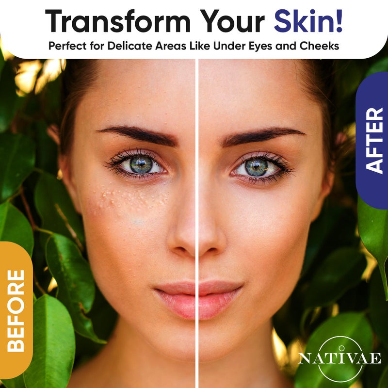 Nativae Milia Remover Treatment for Eyes & Face - Milia Spot Treatment with Salicylic Acid & Tea Tree Oil - Milia Acne Serum - Image 3