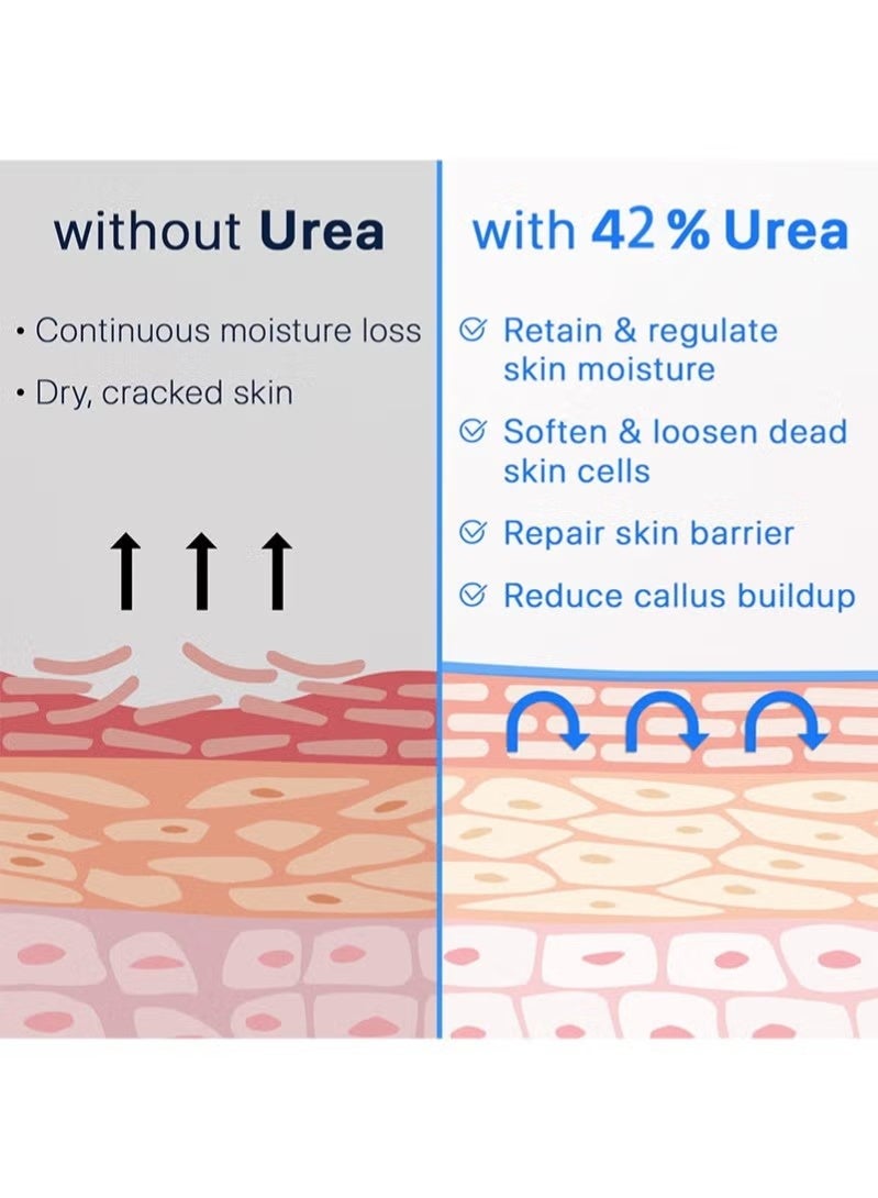 ISSUWEN Urea Cream 42% + Salicylic Acid 2%, Foot Cream for Dry Cracked Heels Knees Elbows Hands Repair Treatment, Foot Moisturizer Corn Callus Dead Skin Remover Toenail Softener for Foot Care - Image 3