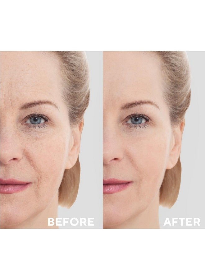 the CEEL Retinol Serum For Face Resurfacing Retinol Serum Firming Anti Aging Brightening Smoothing Fine Lines And Wrinkles Retinol 1% Ceramides And Niacinamide1 Fl.Oz(30 Ml) - Image 3