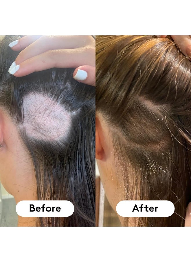 HAIR BURST - Chewable Hair Vitamins - Hair Growth Supplements For Both Men And Women - With Biotin - Anti Hair Loss - For Longer, Stronger, Thicker Looking Hair - 60 Gummies - 30 Day Supply - Image 1
