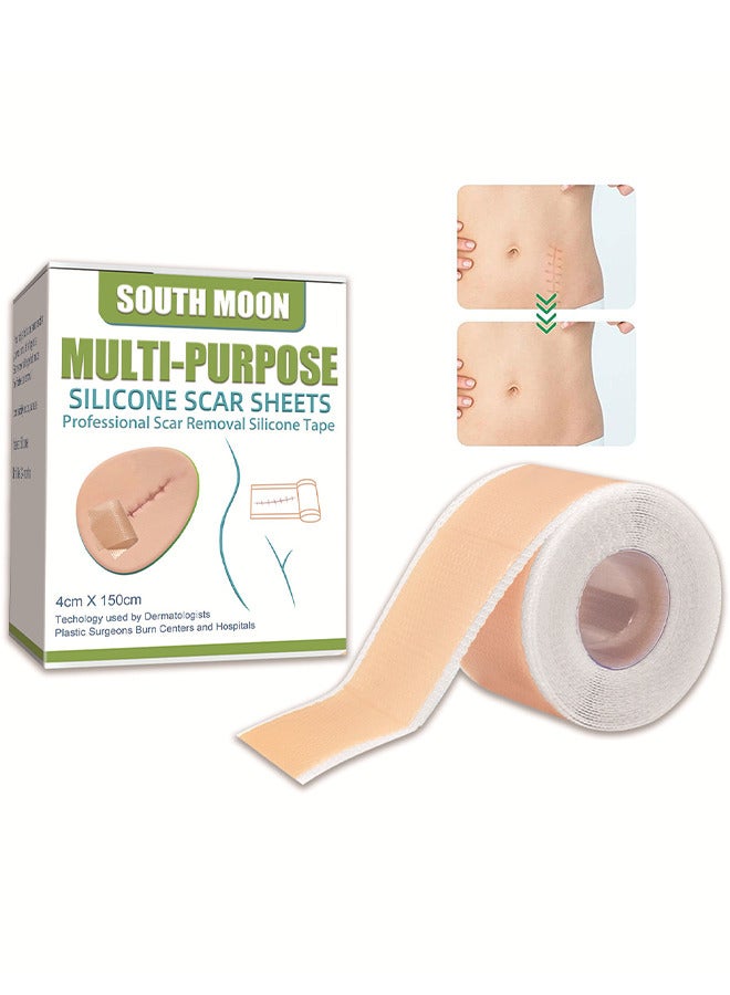 ساوث مون أوراق ندبة السيليكون ، ندوب تتلاشى إزالة ندبة مستحضرات تجميلية فعالة للرقابة القيصرية الندوب والندبات الأخرى التي تركت وراء الهلام لفة غير مؤلمة (4 سم × 1.5 م) - Image 1