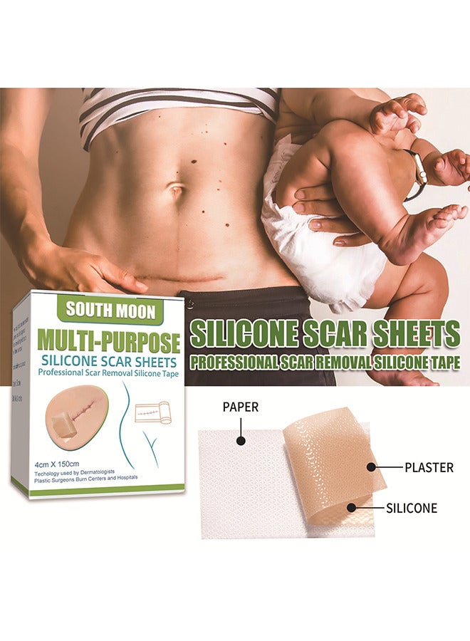 ساوث مون أوراق ندبة السيليكون ، ندوب تتلاشى إزالة ندبة مستحضرات تجميلية فعالة للرقابة القيصرية الندوب والندبات الأخرى التي تركت وراء الهلام لفة غير مؤلمة (4 سم × 1.5 م) - Image 2