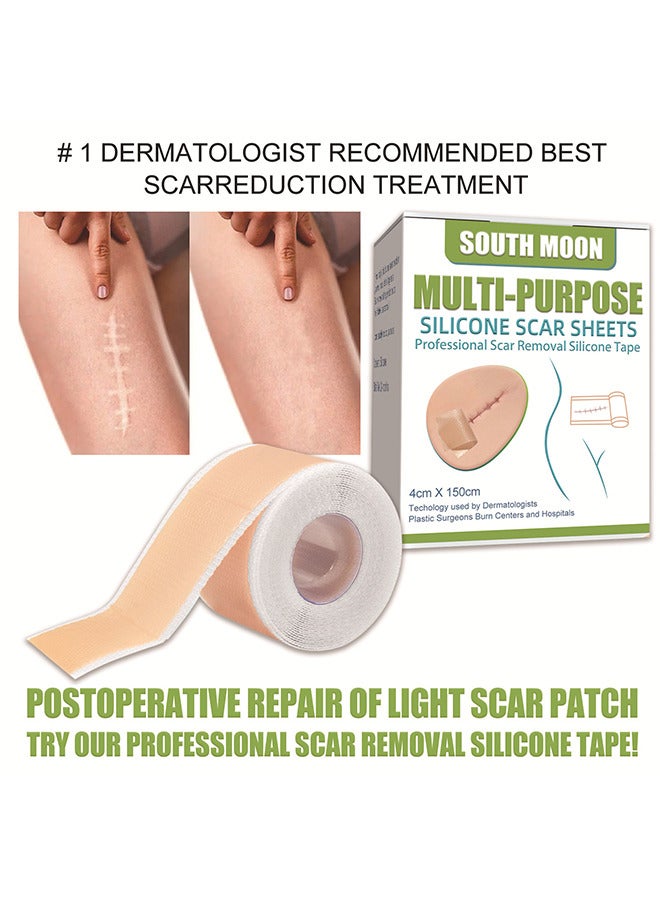 ساوث مون أوراق ندبة السيليكون ، ندوب تتلاشى إزالة ندبة مستحضرات تجميلية فعالة للرقابة القيصرية الندوب والندبات الأخرى التي تركت وراء الهلام لفة غير مؤلمة (4 سم × 1.5 م) - Image 4