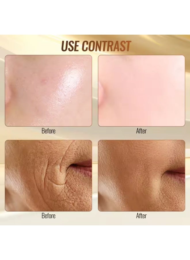 6-in-1 High-Frequency Beauty Device for Deep Cleansing, Acne Treatment, and Skin Tightening with RF Technology - Image 3