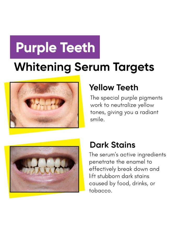 Masofta Purple Teeth Whitening Serum For Yellow & Dark Teeth Stains | With Bromelain & Papain, Purple Toothpaste, For Both Men & Women, 50ML - Image 2