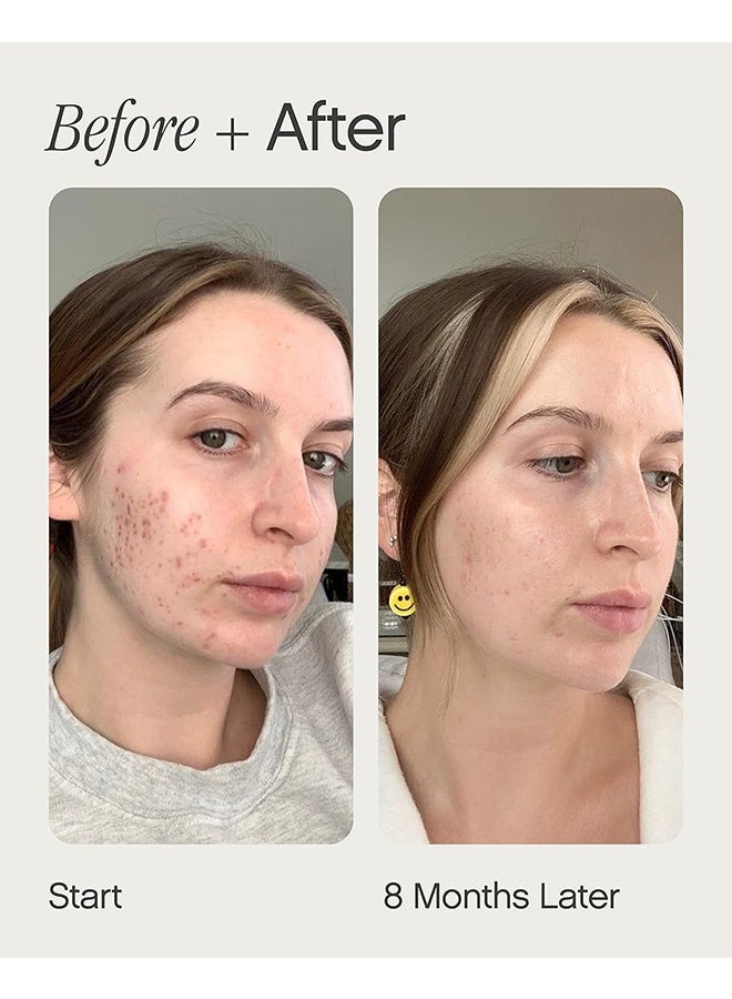 TOPICALS Brightening and Clearing Serum 15ml, Faded Serum for Dark Spots and Discoloration Hyperpigmentation, Postblemish Marks Scars And Spots, Mini Faded Serum for Uneven Skin Tone - Image 4