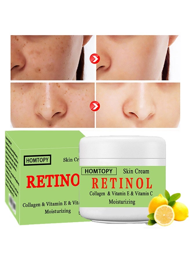 HOMTOPY Retinol And Collagen And Vitamin C Moisturizing Skin Cream, Dark Spot Remover For Face For Face Snd Body Hyperpigmentation, Fades Melasma, Freckle, Sun Spots, Evens Skin Tone, Age Spot Remover 50G