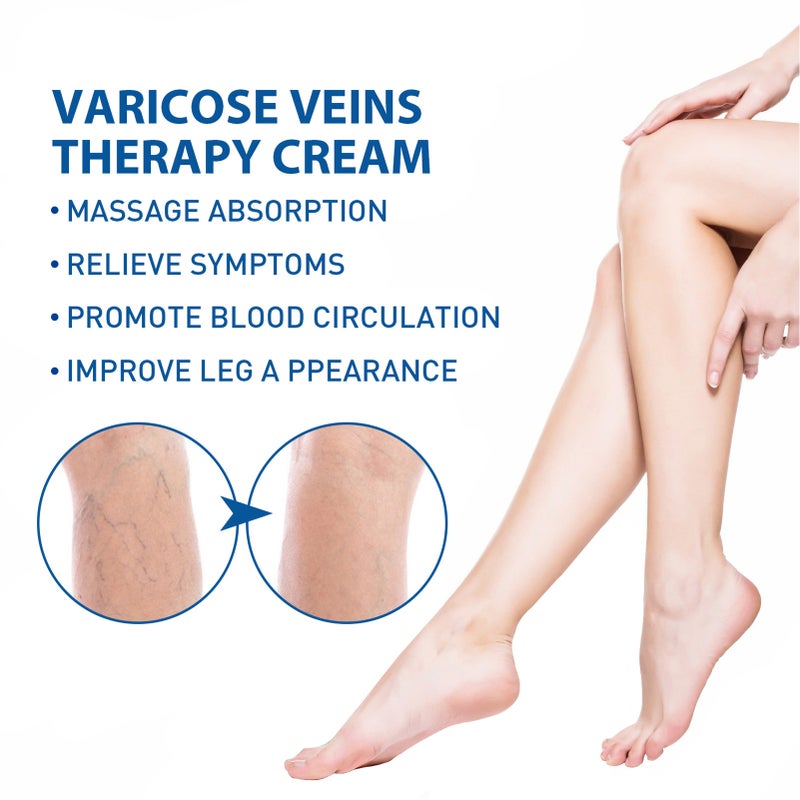West&Month 25g Varicose Veins Therapy Cream + Rod Massage Absorption Relieve Symptoms Recurrence - Image 3