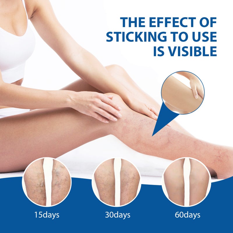 West&Month 25g Varicose Veins Therapy Cream + Rod Massage Absorption Relieve Symptoms Recurrence - Image 2
