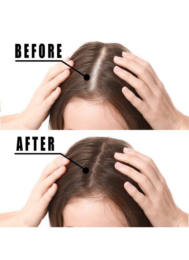 Votala - Hair Growth Serum Votala Hair Growth Treatment Anti Hair Loss Promotes Thicker Stronger Hair And Hair Regrowth For Men Women - Image 1