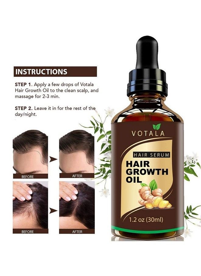 Votala - Hair Growth Serum Votala Hair Growth Treatment Anti Hair Loss Promotes Thicker Stronger Hair And Hair Regrowth For Men Women - Image 1