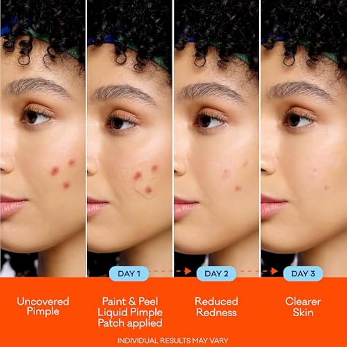 Bioré Paint & Peel Liquid Pimple Patch, Invisible Pimple Patch with Salicylic Acid, Up to 100 Uses, .5 Oz - Image 4