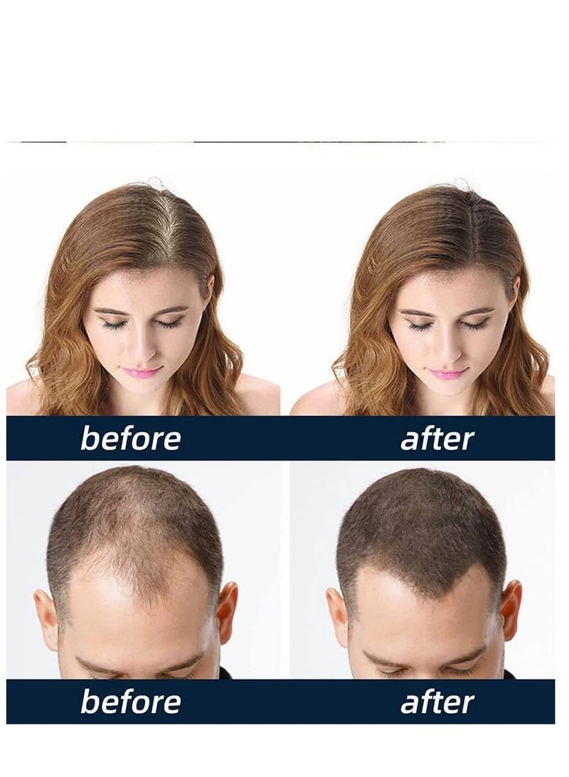 Yrfanni  بخاخ سائل مغذي للشعر، بخاخ HairRevive Biotin، سيروم مركّز لنمو الشعر للحصول على شعر أكثر كثافة وطولاً وقوة، علاج فروة الرأس بالبيوتين 30 مل - Image 4