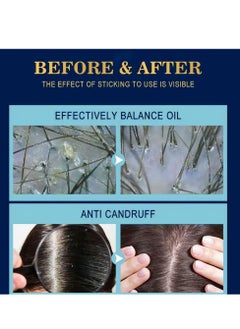 scalpe activating scalp treatment essence spray,Refreshing Relieves dryness Itching irritation,Hair Growth,Hair Loss & Hair Thinning Prevention Treatment,for Men&Women 30ml  - Image 3