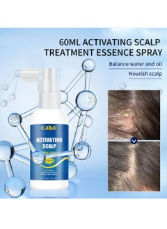 scalpe activating scalp treatment essence spray,Refreshing Relieves dryness Itching irritation,Hair Growth,Hair Loss & Hair Thinning Prevention Treatment,for Men&Women 30ml  - Image 4