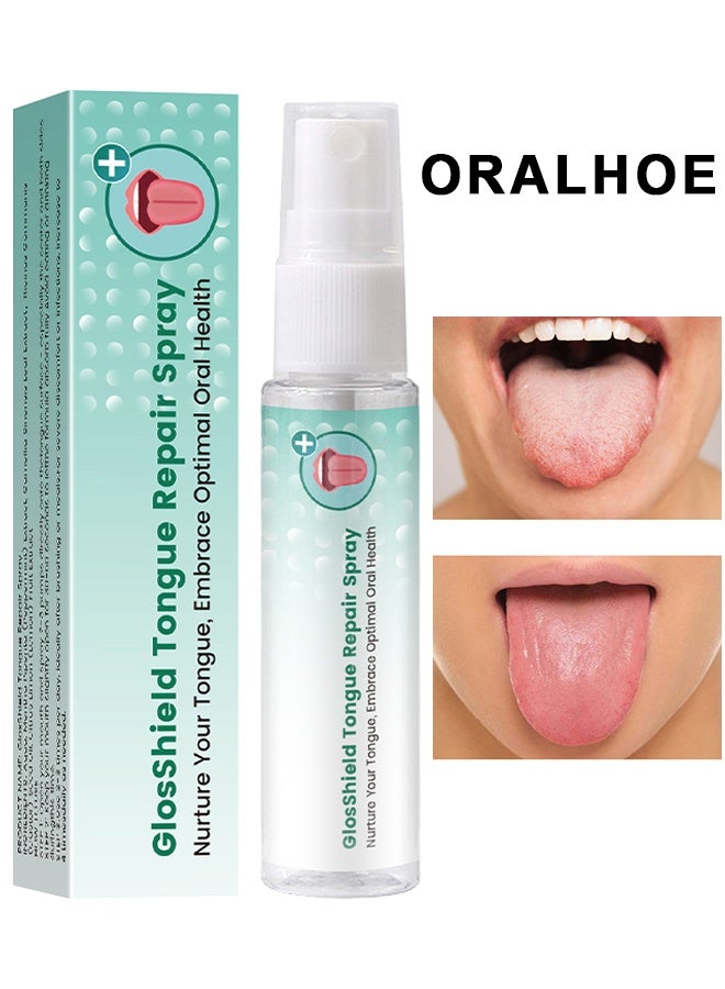 ORALHOE GlosShield Tongue Repair Spray, Mouth Repair Spray Repairs White Tongue Coating, Tongue Care Spray, Portable Mouth Spray, Mouthwash Spray, Freshens Breath, Eliminates Bad Breath, 30ml - Image 1