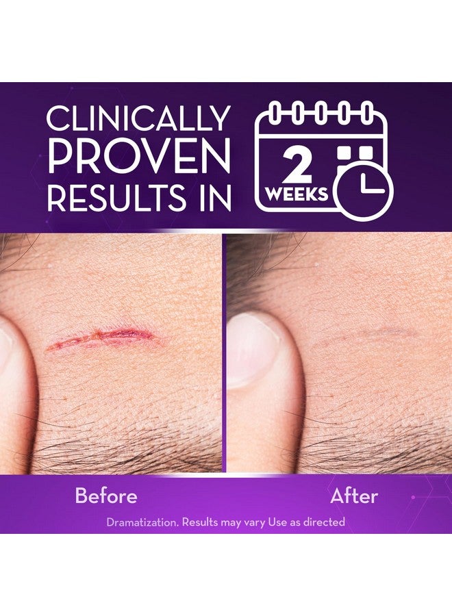 CICATRICURE Cicatricure Advanced Scar Gel for Face & Body - Proven Results in 2 Weeks, Scar Treatment for Surgical Scars, Stretch Marks, Scars of Burns and Injuries, Acne Scar Treatment, 1 oz (28 g) - Pack of 3 - Image 2