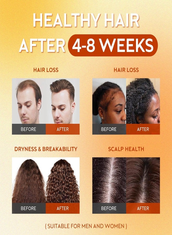 WEEMOTD Raw Batana Oil for Hair Growth Dr Sebi, 100% Pure Organic Batana Hair Mask from Honduras, Wild Growth Hair Oil, Scalp Oil Promotes Hair Thickness, Prevents Loss for Men & Women, 2 fl oz (1 Pack) - Image 4