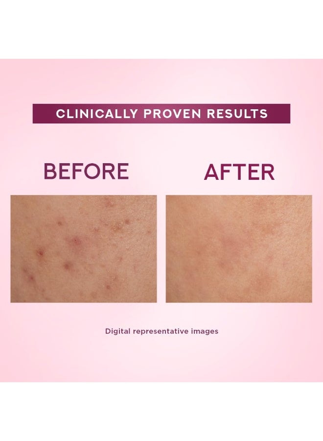 بوندس كريم Pond's Bright Beauty Niasorcinol Light Cream مع مرشح للأشعة فوق البنفسجية | يزيل البقع الداكنة ويفتح البشرة - 50 جم - Image 5