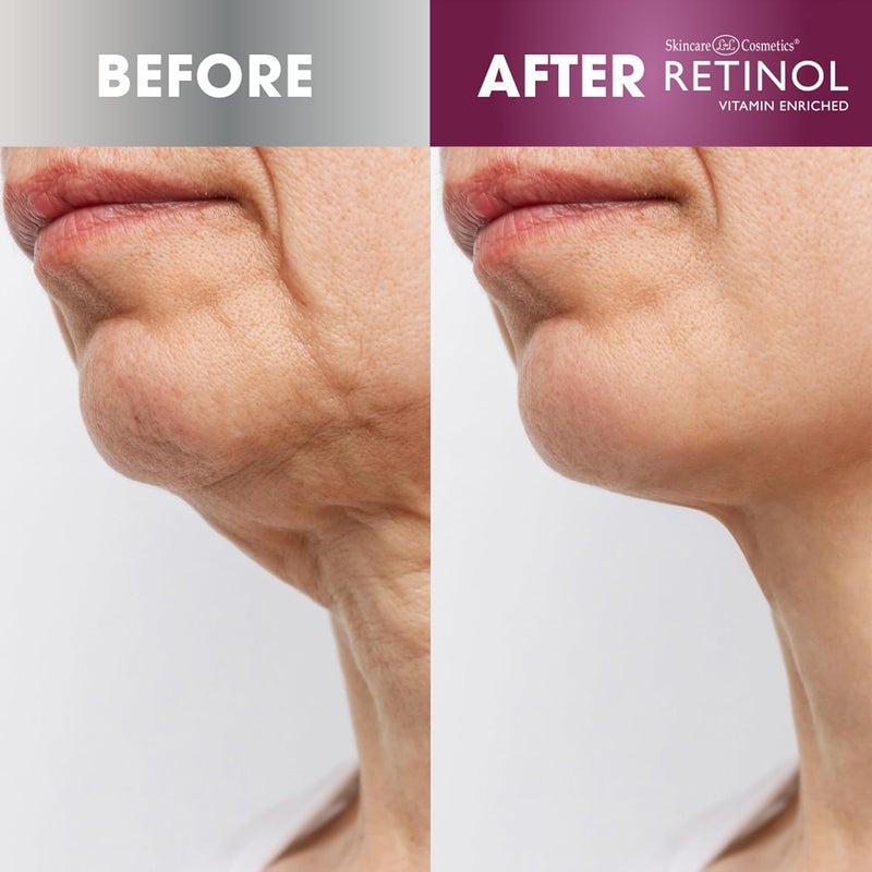 RETINOL كريم شد الرقبة المضاد للشيخوخة بالريتينول يشد وينعم بشرة الرقبة لمظهر شاب 17 أونصة - Image 4