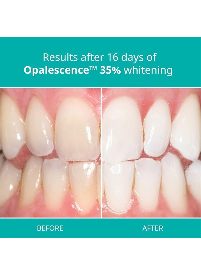 Opalescence - 35% Gel Syringes Teeth Whitening - Refill Kit (6 Pack / 12 Syringes), Made by Ultradent, Carbamide Peroxide in Mint Flavor. Tooth Whitening 5197-12 - Image 1