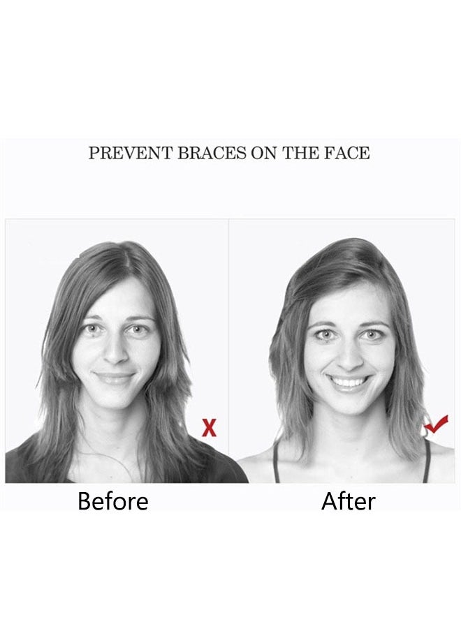 Beauenty 18 Pcs Chewies Orthodontic Handheld Bite Adhesive, Braces Face Correction Bite Adhesive, Food Grade Silicone, Correcting Facial Aesthetics  - Image 2