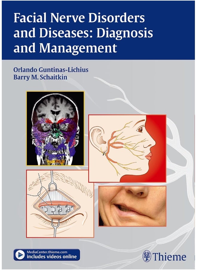 Facial Nerve Disorders and Diseases: Diagnosis and Management 
