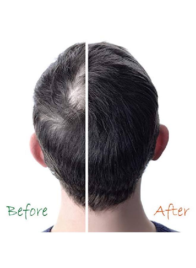 Organic Hair Energizer Organic Hair Growth Booster Pro Vitaminb5 Dhtblocker Sulfatefree & Parabenfree For Thinning & Receding Hair Color Safe For Men Women & Teens 2 Fl Oz  - Image 4