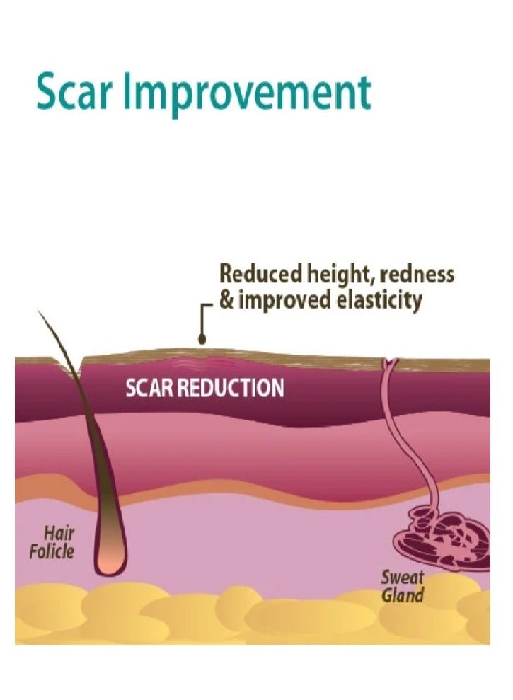 PROSIL Pro-Sil biodermis Patented Silicone Scar - Image 4