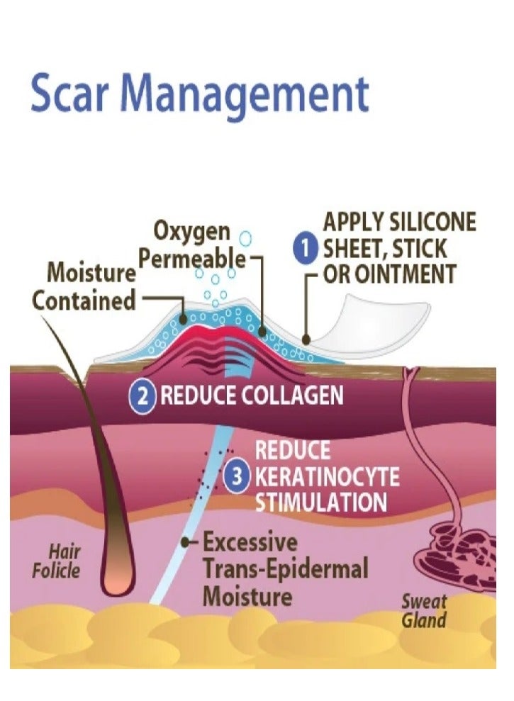 PROSIL Pro-Sil biodermis Patented Silicone Scar - Image 3