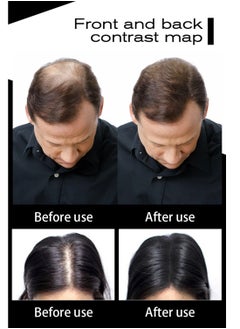 Sevich Hair Fibers Keratin Hairs Building Fiber Powder Instant Growth Refill  - Image 5