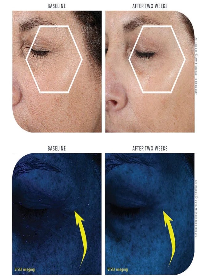 Michael Todd Beauty KNU Serum - Face Lifting, Brightening & Tightening Serum - For Restoring & Rejuvenating - With Aloe Vera, SSF, Peptides & Botanical Extracts - For All Skin Types - 1.01 fl oz/30 mL - Image 5