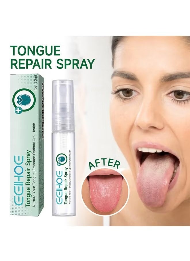 EELHOE Tongue Repair Spray,Mouth Repair Spray Repairs White Tongue Coating, Tongue Care Spray, Portable Mouth Spray, Mouthwash Spray, Freshens Breath, Eliminates Bad Breath 30ml  - Image 1