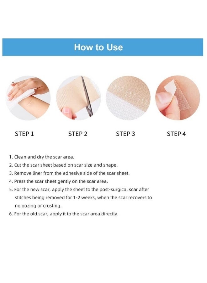 Hodaf Silicone Scar Sheets Stretch Mark Treatment Waterproof Silicone Gel Tape - Image 3
