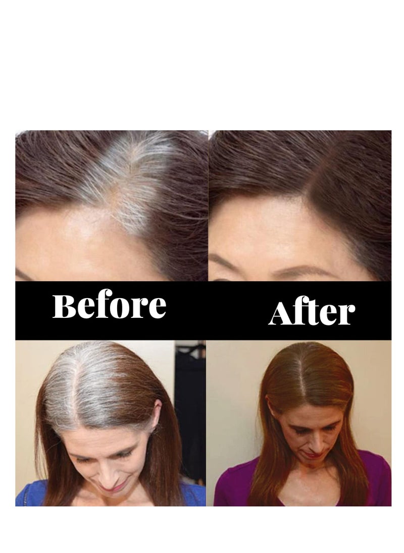 SYOSI - Root Touch Up, Hair Dye Pen, Root Cover Up Black, Hairline Powder Stick, Haircolor Touch-Up Stick to Cover Gray Hair Root, Semi-permanent Root Hair Coloring (Brown) - Image 1