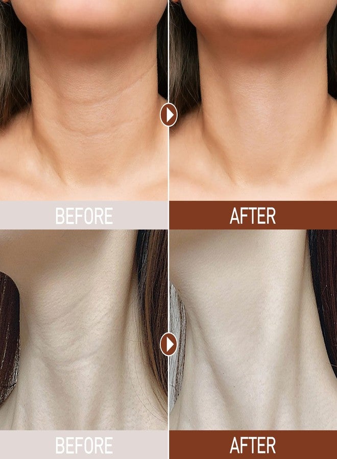 Anti-Aging Neck Mask Patches - Golden Hydrating Collagen Pads for Neck Wrinkles, Deep Moisturizing Treatment with Hyaluronic Acid for Firming & Smoothing (5 PCS) - Image 2