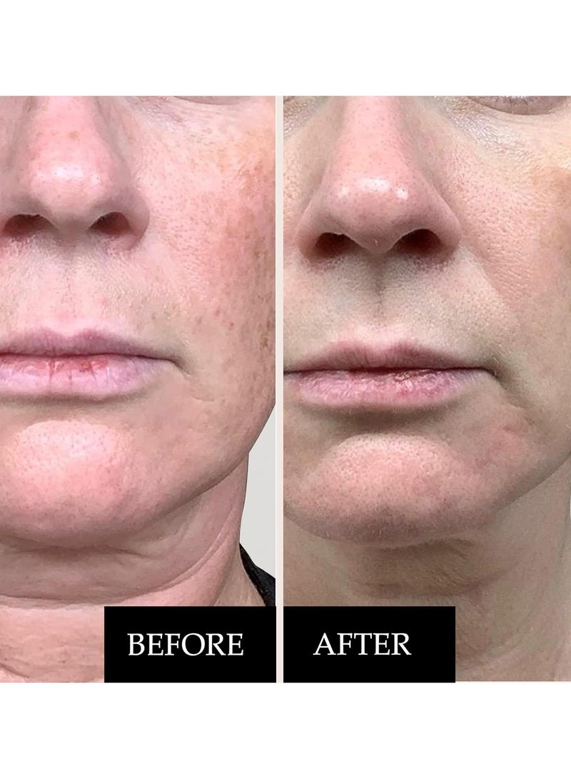 Kleem Organics Vitamin C Serum for Face with Hyaluronic Acid and Vitamin E Firming Anti Aging Vitamin C Face Serum for Women to Boost Collagen Reduce Wrinkles Acne Spots Dark Spots and Sun Damage - Image 2