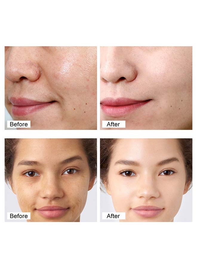 Retinol Face Cream For Skin Whitening Face Moisturnizer For Dry Skin Anti Wrinkle Firming Skin Rejuvenation Reduce Fine Lines Firming Whitening 30g