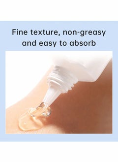AuQuest Acne Remoyal Gure Gel -Herbal Acne Treatment Cream Pimple Spot Removal for Teens Oil Control Acne Scar Gel Shrink Pores Skin Care Beauty Health 20g  - Image 4