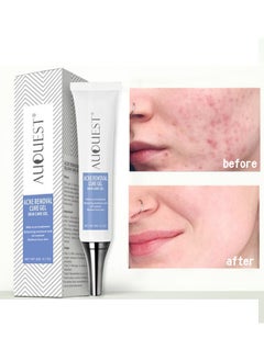 AuQuest Acne Remoyal Gure Gel -Herbal Acne Treatment Cream Pimple Spot Removal for Teens Oil Control Acne Scar Gel Shrink Pores Skin Care Beauty Health 20g  - Image 1