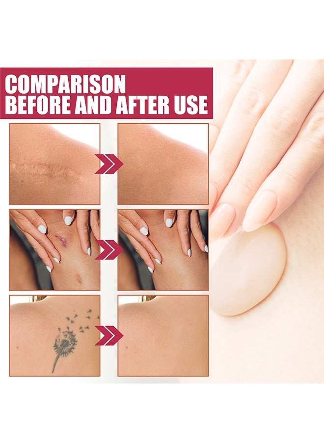 إيلهو مؤسسة تغطية مكياج الجسم، مؤسسة التغطية الكاملة والمكياج المخفي لتغطية الندوب، الكدمات، الوشم، البهاق - Image 4